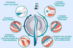 Proceso de limpieza de dientes a seguir por parte del paciente.