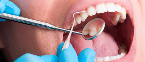 Revisión dental.