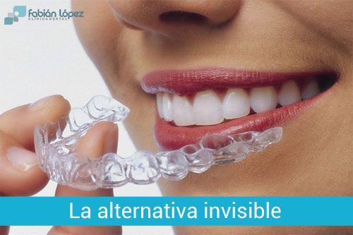 Invisalign - Ortodoncia invisible